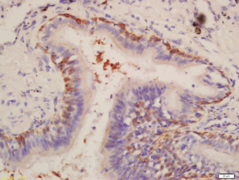 Cytokeratin 3 Rabbit Polyclonal Antibody