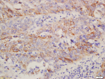 Cytokeratin 3 Rabbit Polyclonal Antibody