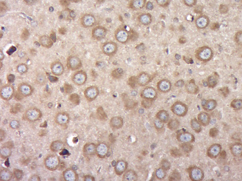 C1orf84 Rabbit Polyclonal Antibody