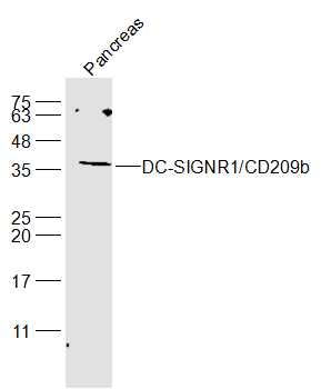 DC-SIGNR1/CD209b Rabbit Polyclonal Antibody