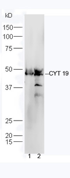 CYT 19 Rabbit Polyclonal Antibody