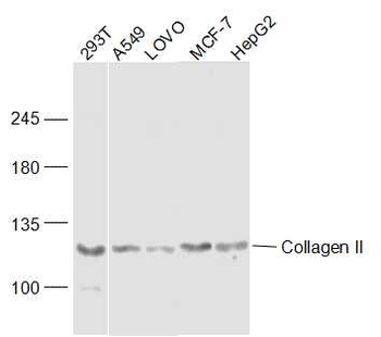 Collagen II Rabbit Polyclonal Antibody