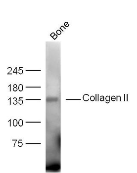 Collagen II Rabbit Polyclonal Antibody