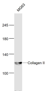 Collagen II Rabbit Polyclonal Antibody