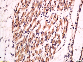 Collagen II Rabbit Polyclonal Antibody
