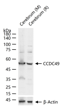 CCDC49 Rabbit Polyclonal Antibody