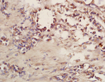 CD101 Rabbit Polyclonal Antibody