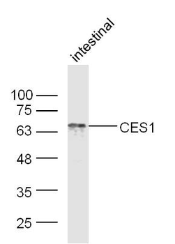 CES1/Liver Carboxylesterase 1 Rabbit Polyclonal Antibody