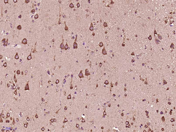 C20orf201 Rabbit Polyclonal Antibody