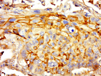 CLEC16A Rabbit Polyclonal Antibody