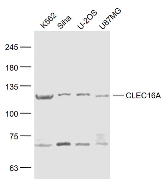 CLEC16A Rabbit Polyclonal Antibody