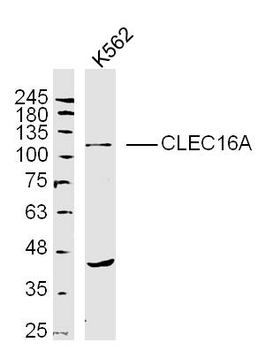 CLEC16A Rabbit Polyclonal Antibody