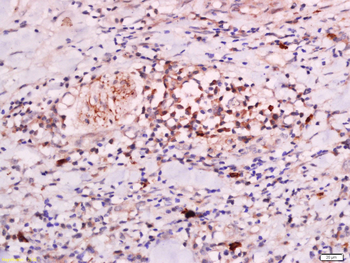 CLEC16A Rabbit Polyclonal Antibody