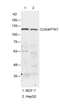 CCK4/PTK7 Rabbit Polyclonal Antibody