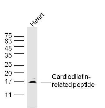 Cardiodilatin-related peptide Rabbit Polyclonal Antibody