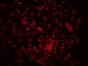 DACT1 Rabbit Polyclonal Antibody