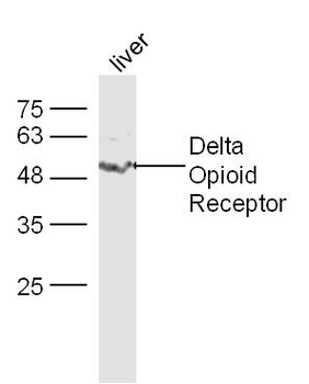 Delta Opioid Receptor Rabbit Polyclonal Antibody