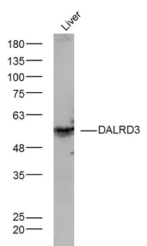 DALRD3 Rabbit Polyclonal Antibody