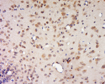 DALRD3 Rabbit Polyclonal Antibody