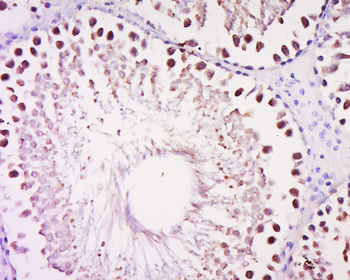 DALRD3 Rabbit Polyclonal Antibody