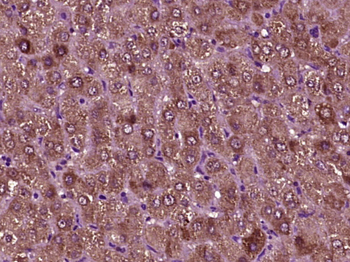 DARS Rabbit Polyclonal Antibody