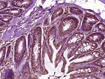 DBNDD1 Rabbit Polyclonal Antibody