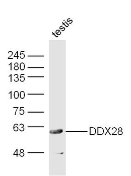 DDX28 Rabbit Polyclonal Antibody