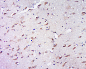 DDX28 Rabbit Polyclonal Antibody
