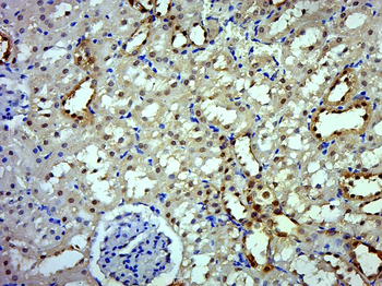 DDX49 Rabbit Polyclonal Antibody