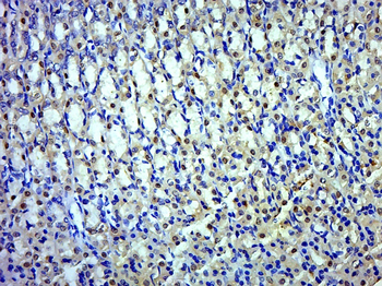 DDX49 Rabbit Polyclonal Antibody