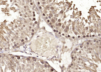 DDX55 Rabbit Polyclonal Antibody