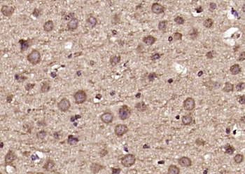 DDX60 Rabbit Polyclonal Antibody