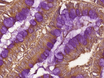 DEFB121 Rabbit Polyclonal Antibody