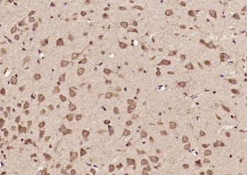 DENND5A Rabbit Polyclonal Antibody