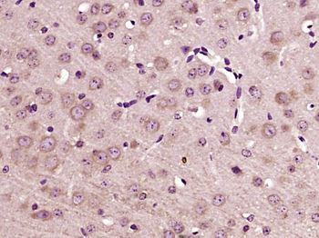 DEXI Rabbit Polyclonal Antibody