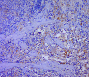 DFNA5 Rabbit Polyclonal Antibody