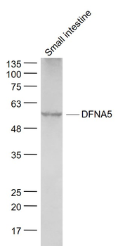 DFNA5 Rabbit Polyclonal Antibody