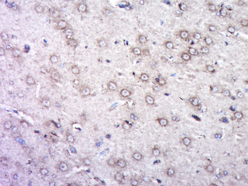 DGKG Rabbit Polyclonal Antibody