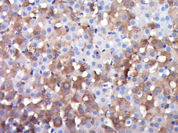DGKK Rabbit Polyclonal Antibody