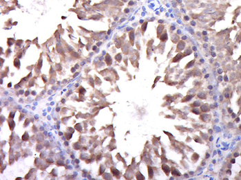 DGKK Rabbit Polyclonal Antibody