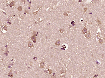DHI1L Rabbit Polyclonal Antibody