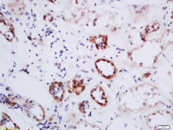 DHI1L Rabbit Polyclonal Antibody