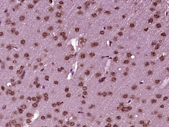 DHX33 Rabbit Polyclonal Antibody