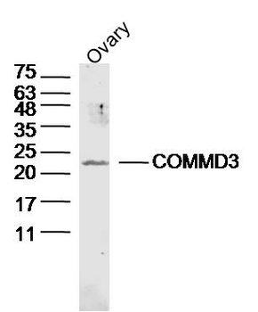 COMMD3 Rabbit Polyclonal Antibody