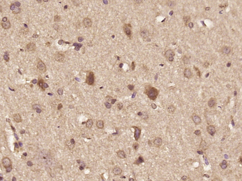 DHX36 Rabbit Polyclonal Antibody