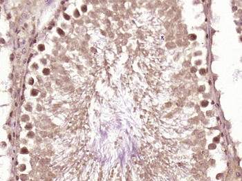 DHX36 Rabbit Polyclonal Antibody