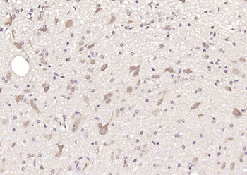 DIAPH3 Rabbit Polyclonal Antibody