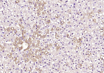 DIAPH3 Rabbit Polyclonal Antibody