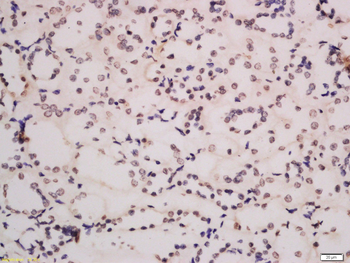 DIEXF Rabbit Polyclonal Antibody