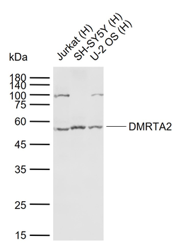 DMRTA2 Rabbit Polyclonal Antibody